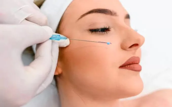 Aplicação de bioestimulador de colágeno na face